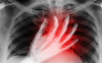 Két napig tüdő nélkül élt egy férfi