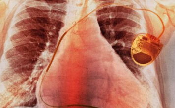 Forradalmi újdonság: megalkották a pacemakert, amit a szív lát el energiával