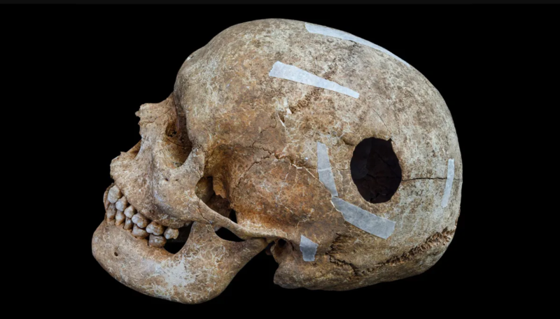 Rejt&eacute;lyes &oacute;ri&aacute;st rejtett az ősi cambridge-i t&ouml;megs&iacute;r