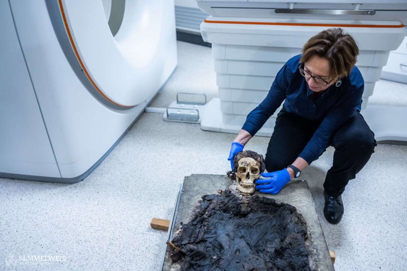 Budapesten tal&aacute;lt r&oacute;mai m&uacute;mi&aacute;n v&eacute;geztek CT-vizsg&aacute;latot