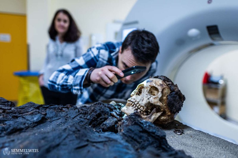 Budapesten tal&aacute;lt r&oacute;mai m&uacute;mi&aacute;n v&eacute;geztek CT-vizsg&aacute;latot