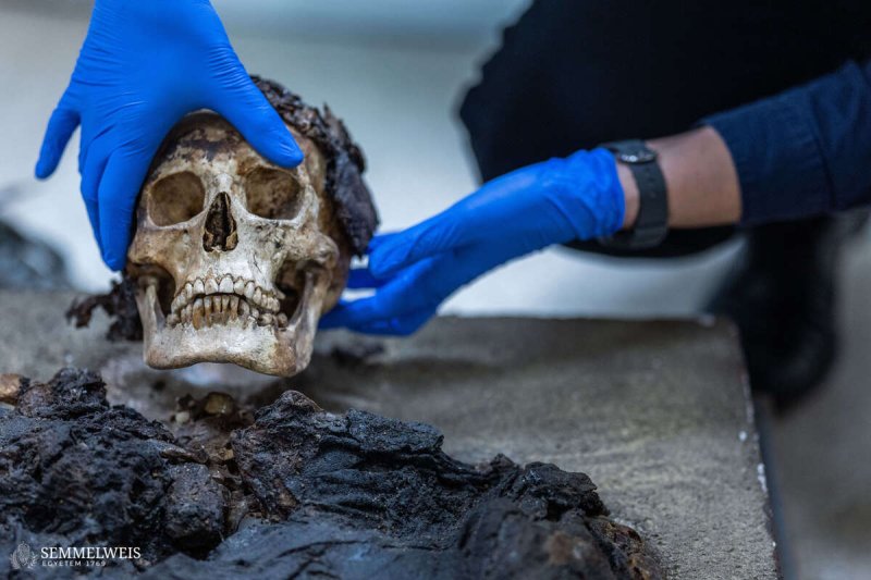 Budapesten tal&aacute;lt r&oacute;mai m&uacute;mi&aacute;n v&eacute;geztek CT-vizsg&aacute;latot