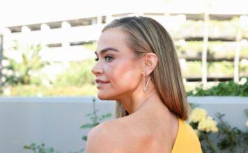 Denise Richards sokkoló előtte-utána fotókat mutatott az arcplasztikájáról