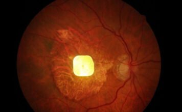 Milliók látását adhatja vissza egy új, kísérleti eszköz