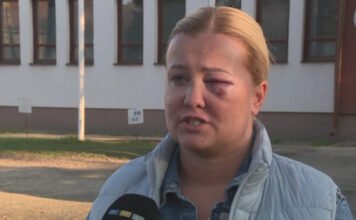 Politikai nézetkülönbség miatt fajulhatott el a vita – állítja a nő, akit összevert a szentmártonkátai alpolgármester