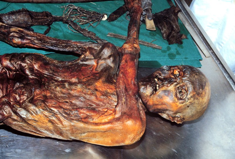 Meglepő dologra bukkantak &Ouml;tzi, az 5000 &eacute;ves j&eacute;gm&uacute;mia vizsg&aacute;lata sor&aacute;n